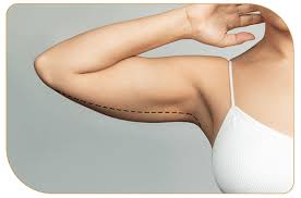 Braquioplastia — Dr. Marcelo Resende